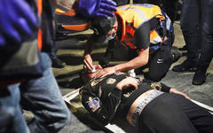 Un palestino recibe tratamiento después de ser agredido durante los enfrentamientos en la Puerta de Damasco, a las afueras de la Ciudad Vieja de Jerusalén. Foto: AFP.